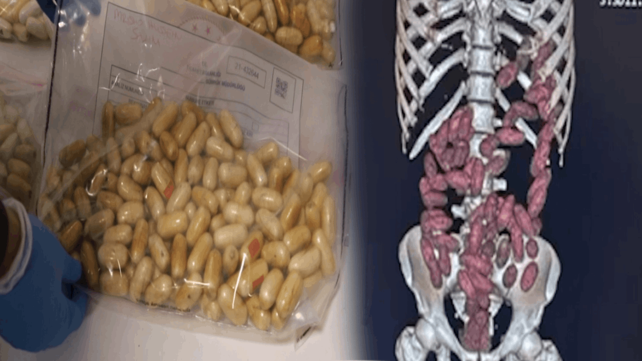 Vücutlarından 29,7 kilo uyuşturucu çıktı